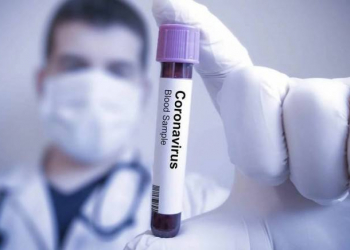 Azərbaycanda koronavirusa 46 yeni yoluxma qeydə alınıb, 4 nəfər ölüb