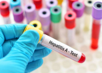 TƏBİB: Bir sıra regionlarda hepatit A virusuna yoluxma müşahidə edilir