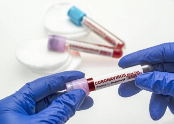 Son sutkada koronavirusdan 4 nəfər ölüb